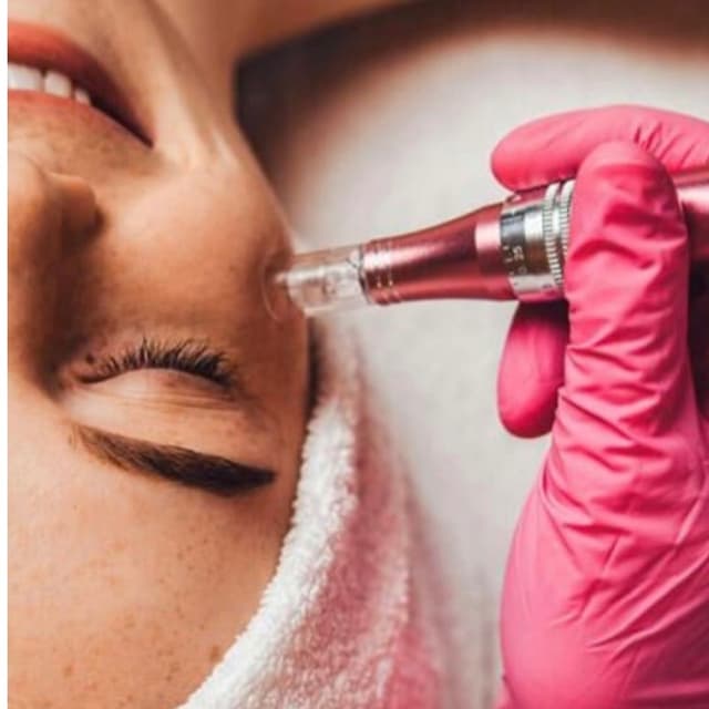 Microneedling Face- Package of 6 at Glow & Behold in Durham, NC
