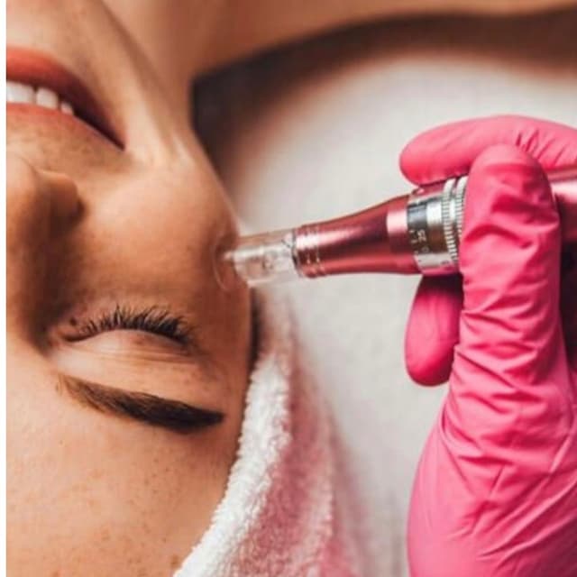 Microneedling Face Package of 3 at Glow & Behold in Durham, NC
