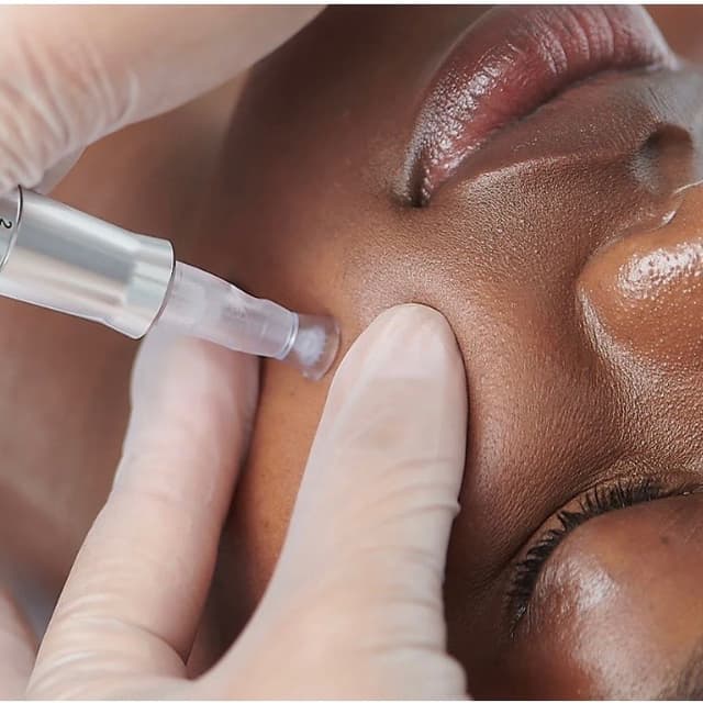 Glass Skin Infusion Therapy at Glow & Behold in Durham, NC